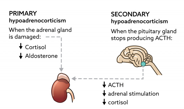 Addison Disease