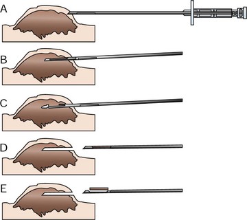 Biopsy & Histopathology