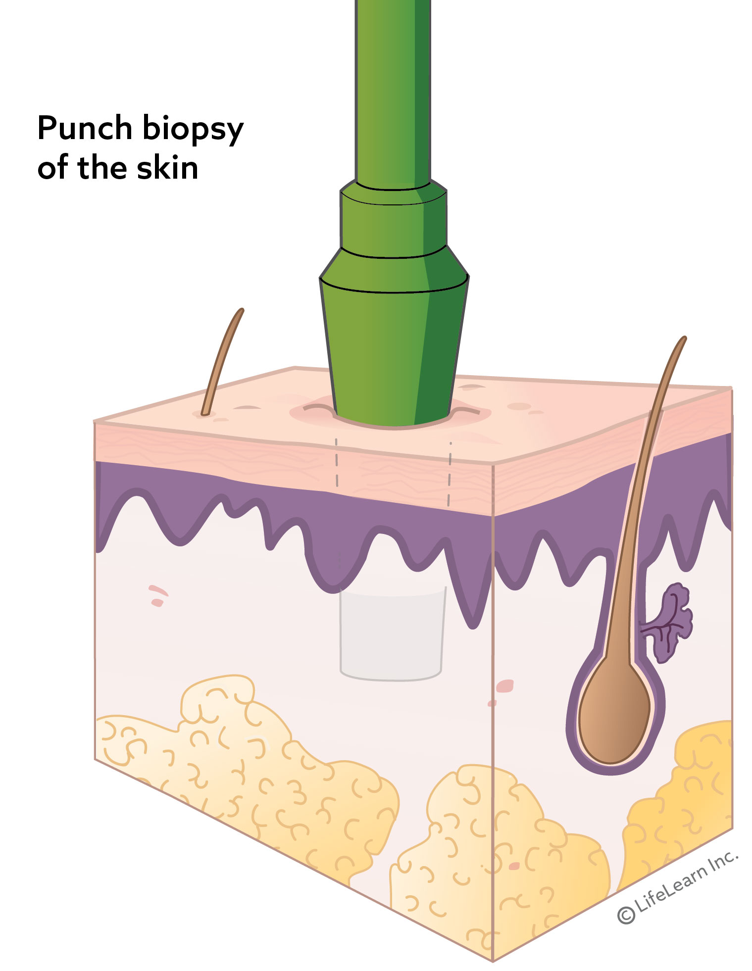 Biopsy & Histopathology