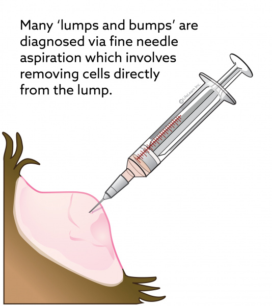 Fine Needle Aspiration