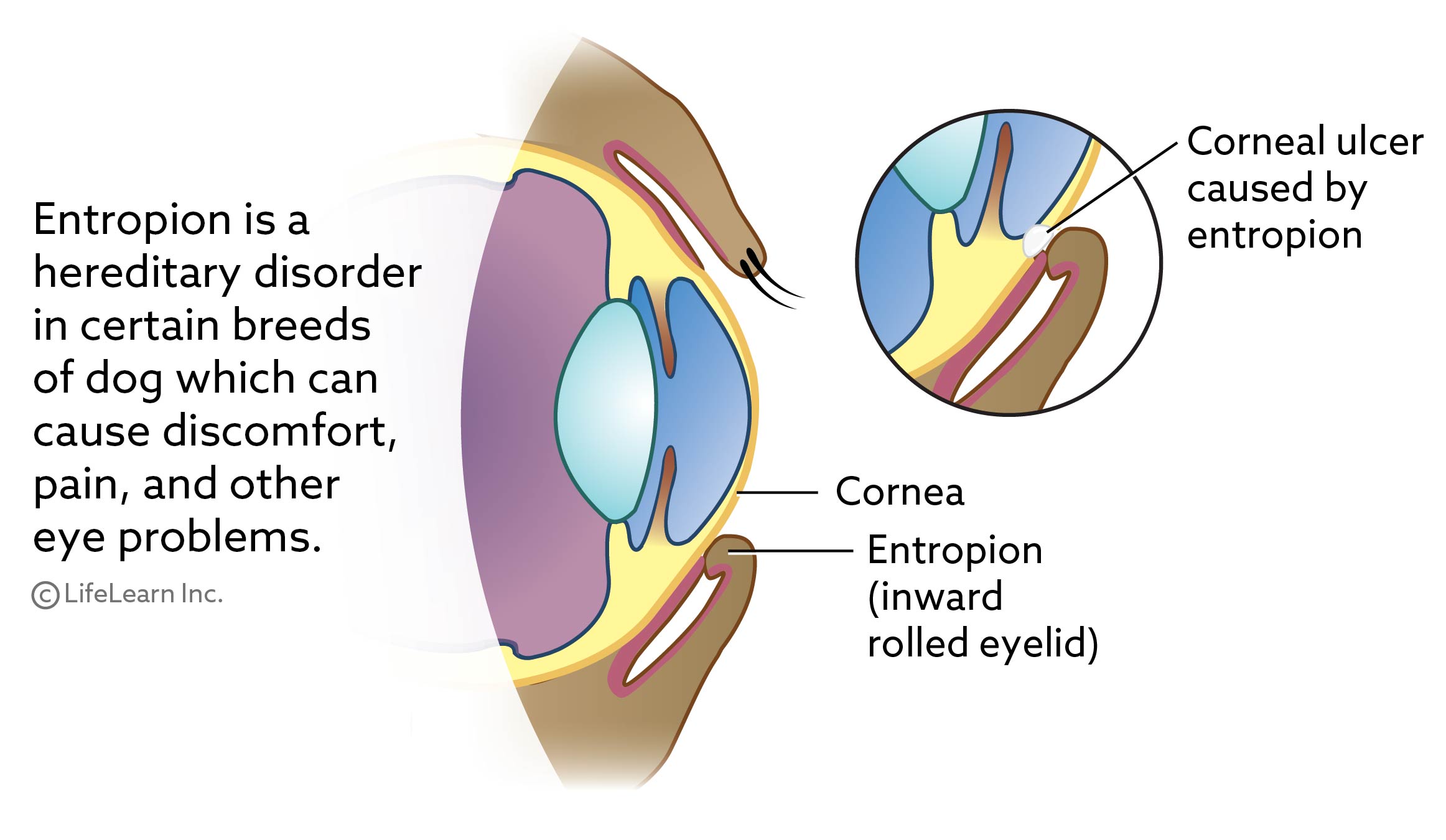 Entropion