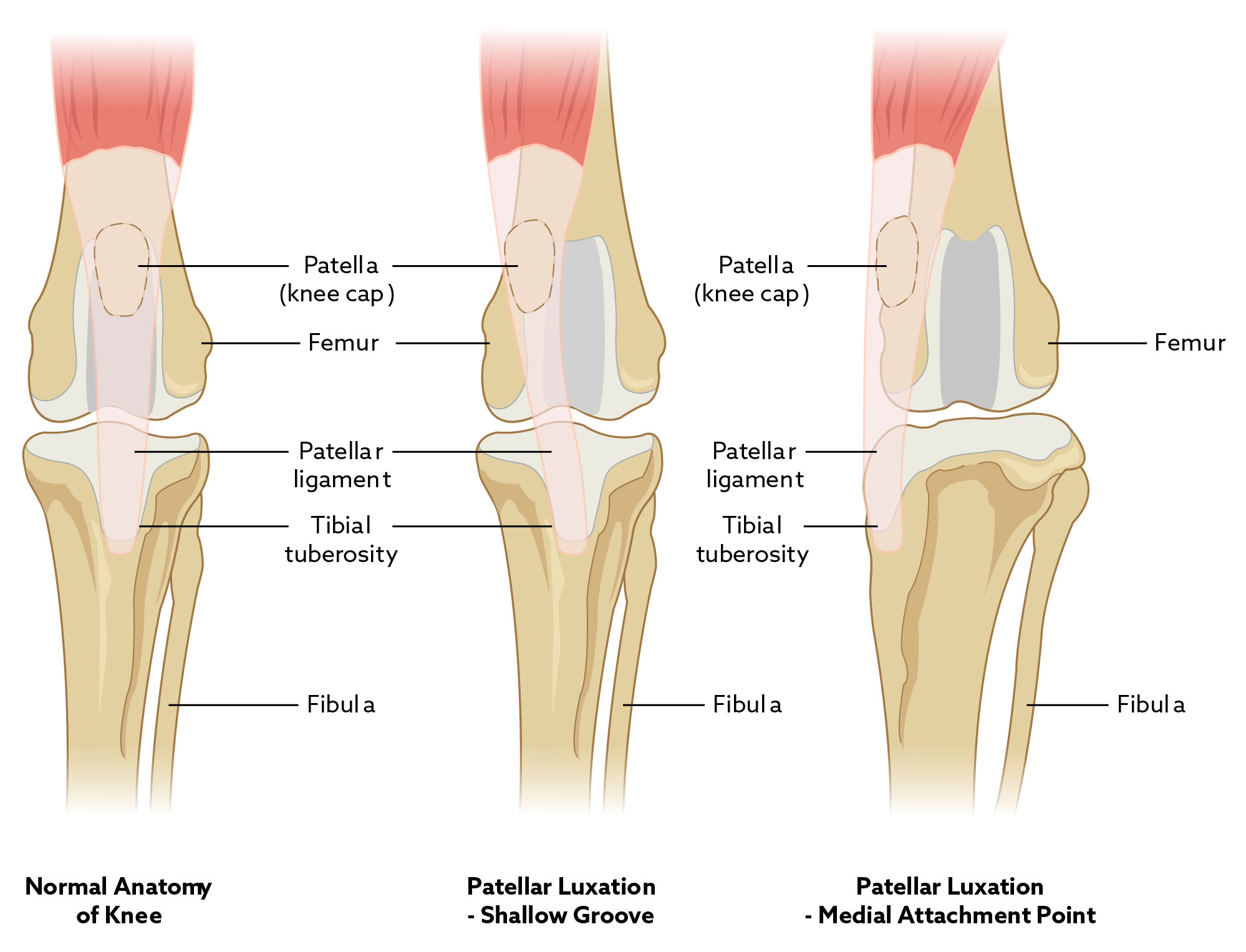 Patella luxation in Dogs