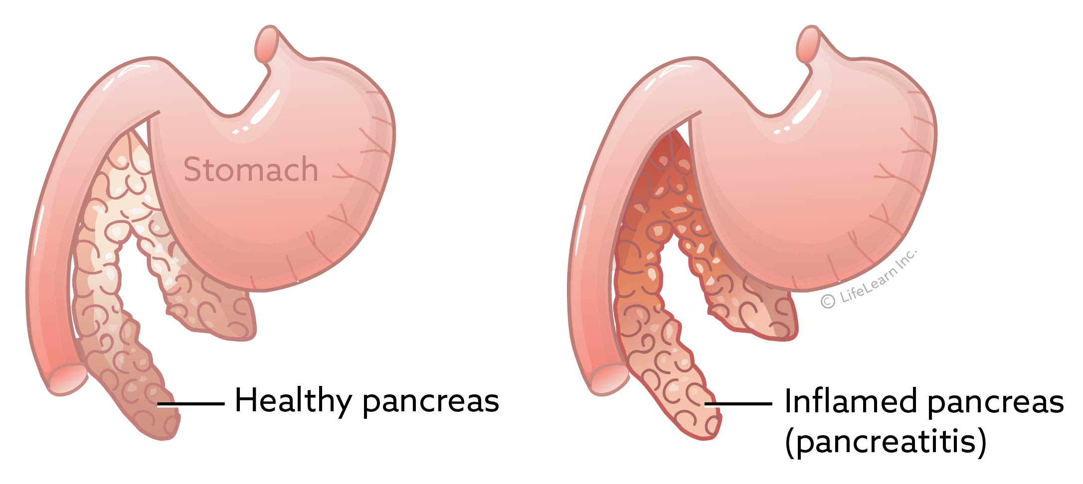 Pancreatitis in Dogs