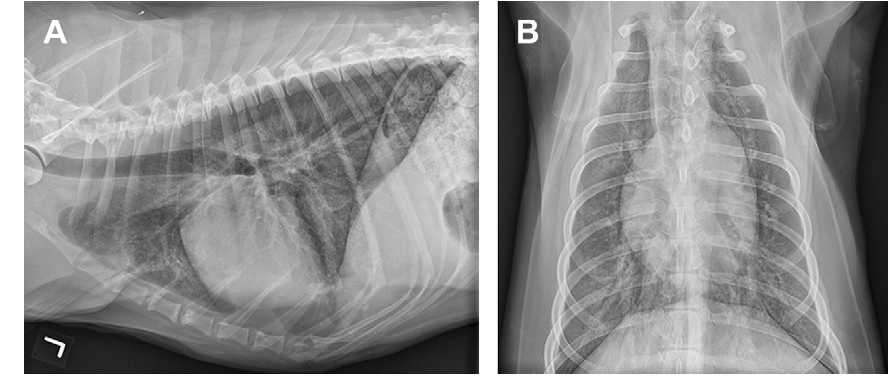 Pulmonary Hypertension