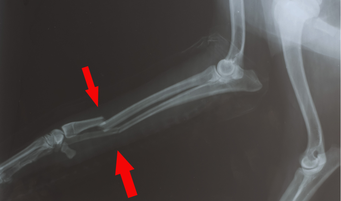 Traumatic Bone Injury & Fracture