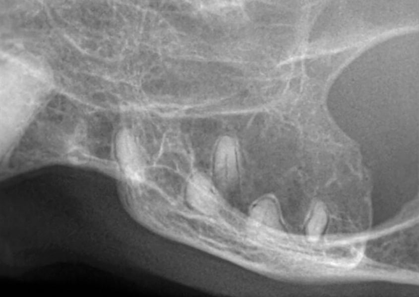 Lymphocytic Plasmacytic Gingivostomatitis gingivitis and stomatitis